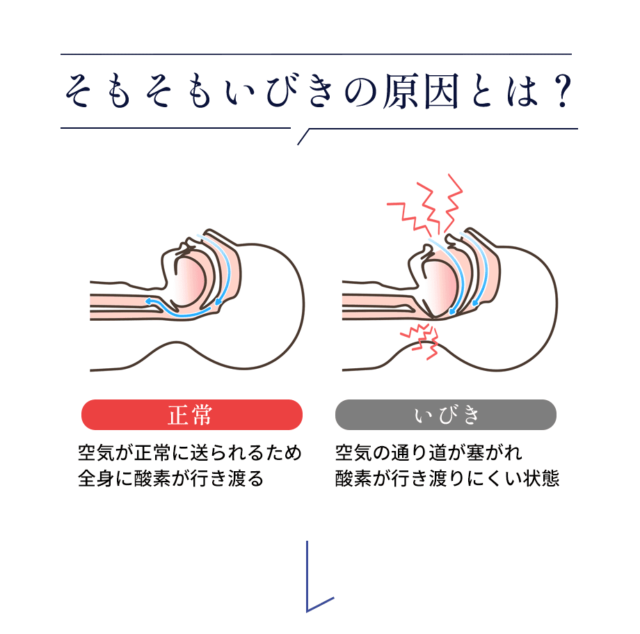 いびきの原因とは