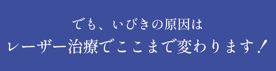 最新いびきレーザー治療　FOTONAナイトレーズ