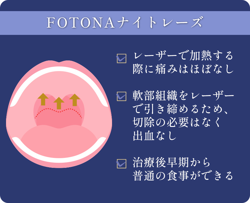 最新いびきレーザー治療　FOTONAナイトレーズ